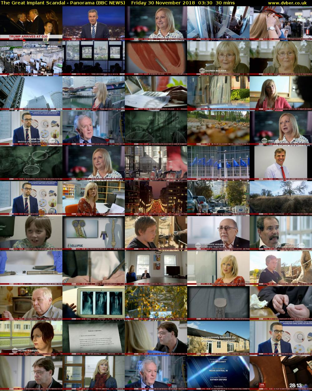 The Great Implant Scandal - Panorama (BBC NEWS) Friday 30 November 2018 03:30 - 04:00