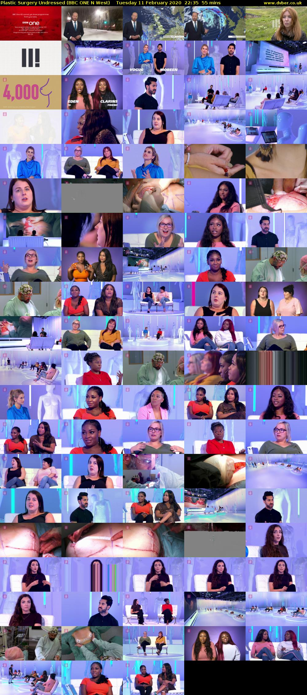 Plastic Surgery Undressed (BBC ONE N West) Tuesday 11 February 2020 22:35 - 23:30