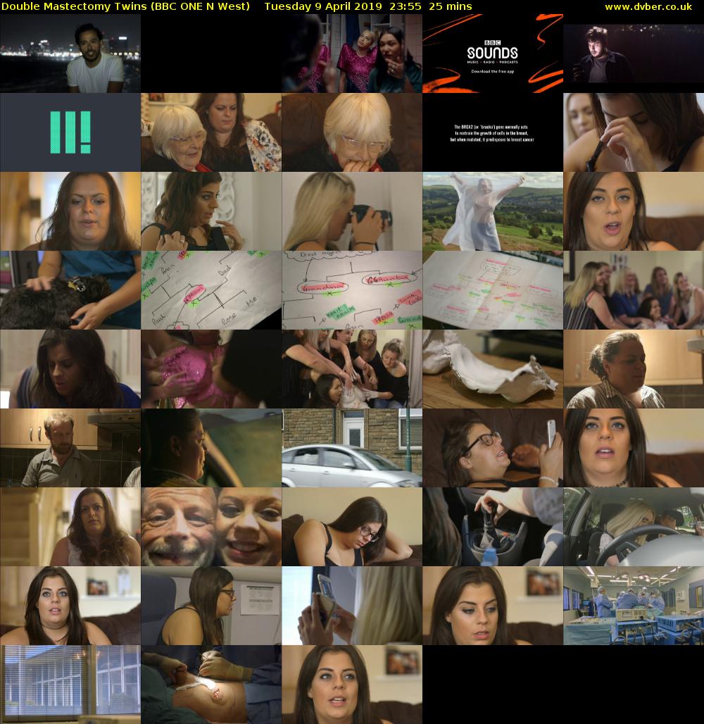Double Mastectomy Twins (BBC ONE N West) Tuesday 9 April 2019 23:55 - 00:20