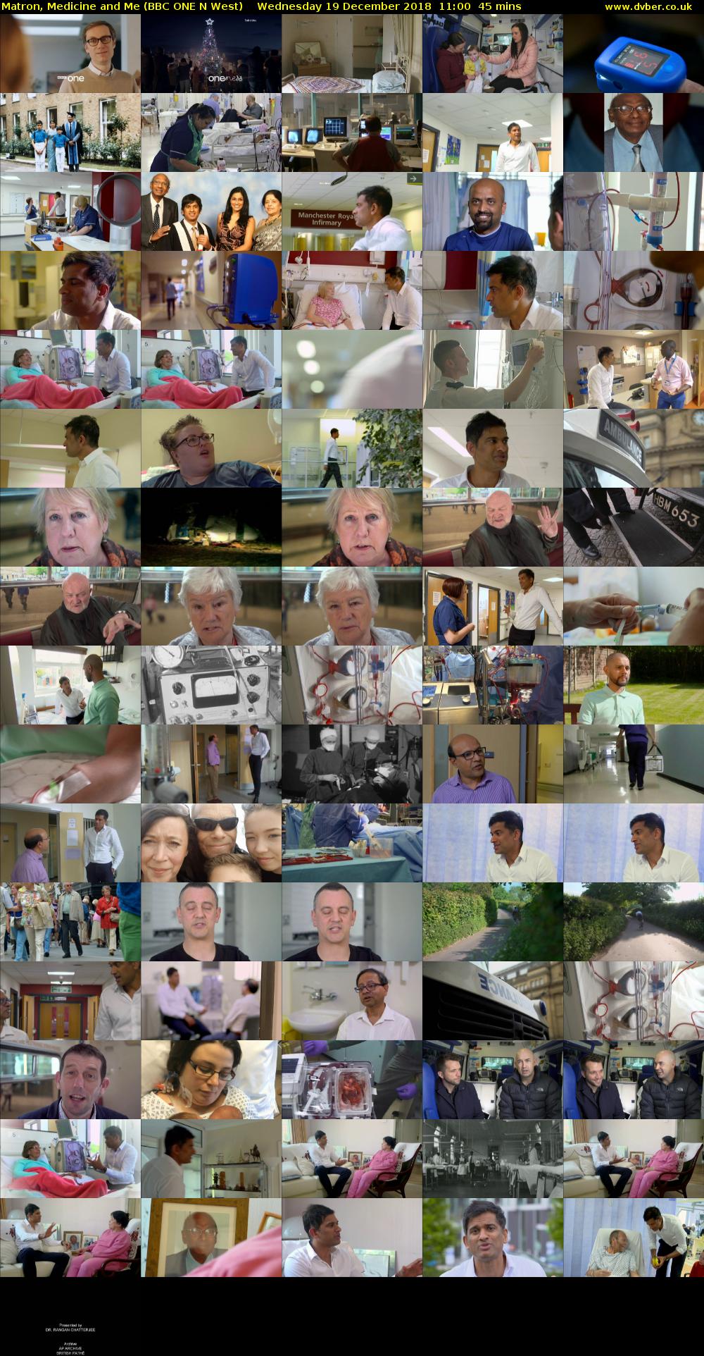 Matron, Medicine and Me (BBC ONE N West) Wednesday 19 December 2018 11:00 - 11:45