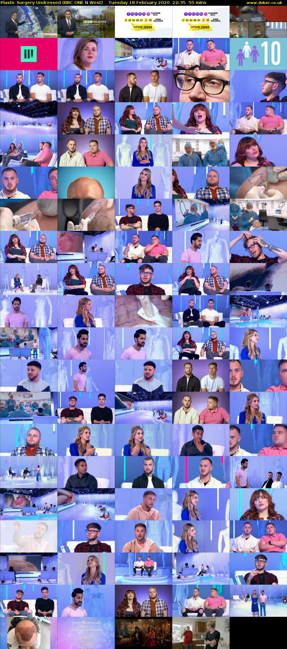 Plastic Surgery Undressed (BBC ONE N West) Tuesday 18 February 2020 22:35 - 23:30