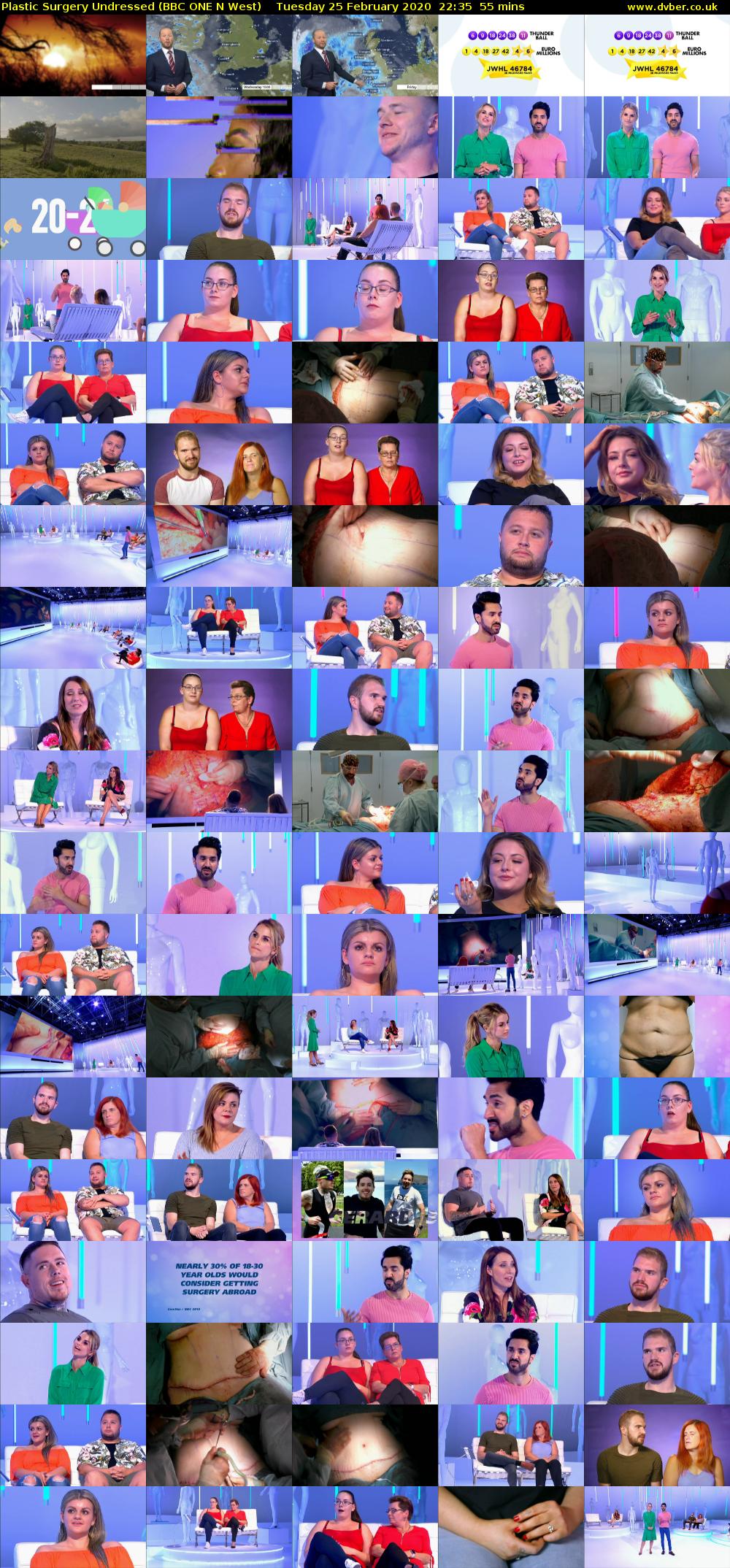 Plastic Surgery Undressed (BBC ONE N West) Tuesday 25 February 2020 22:35 - 23:30