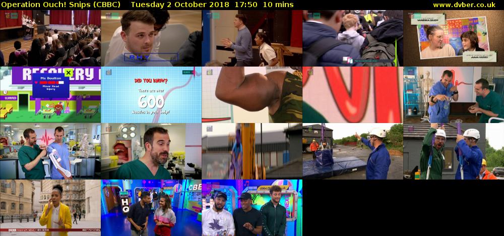 Operation Ouch! Snips (CBBC) Tuesday 2 October 2018 17:50 - 18:00