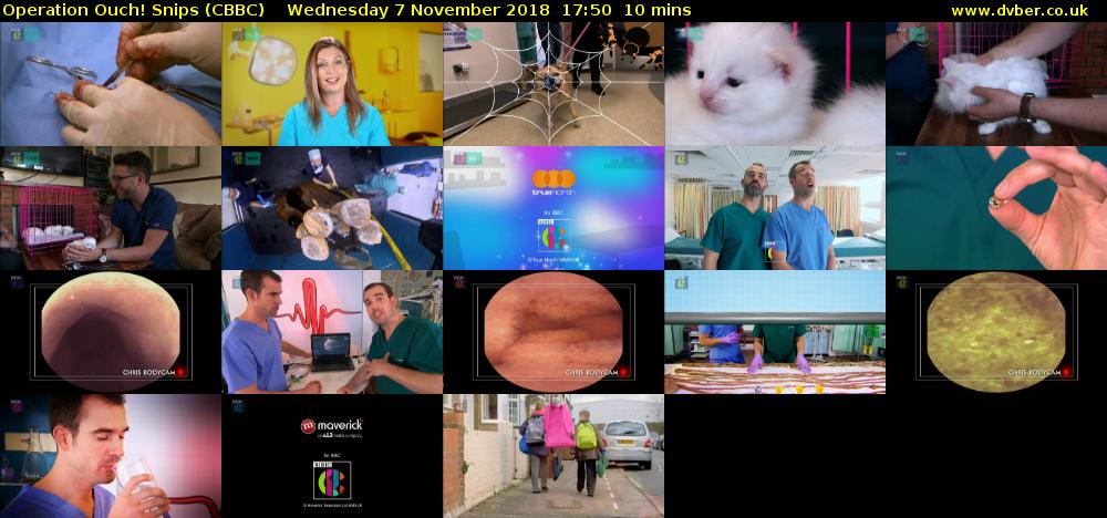 Operation Ouch! Snips (CBBC) Wednesday 7 November 2018 17:50 - 18:00