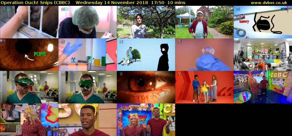 Operation Ouch! Snips (CBBC) Wednesday 14 November 2018 17:50 - 18:00