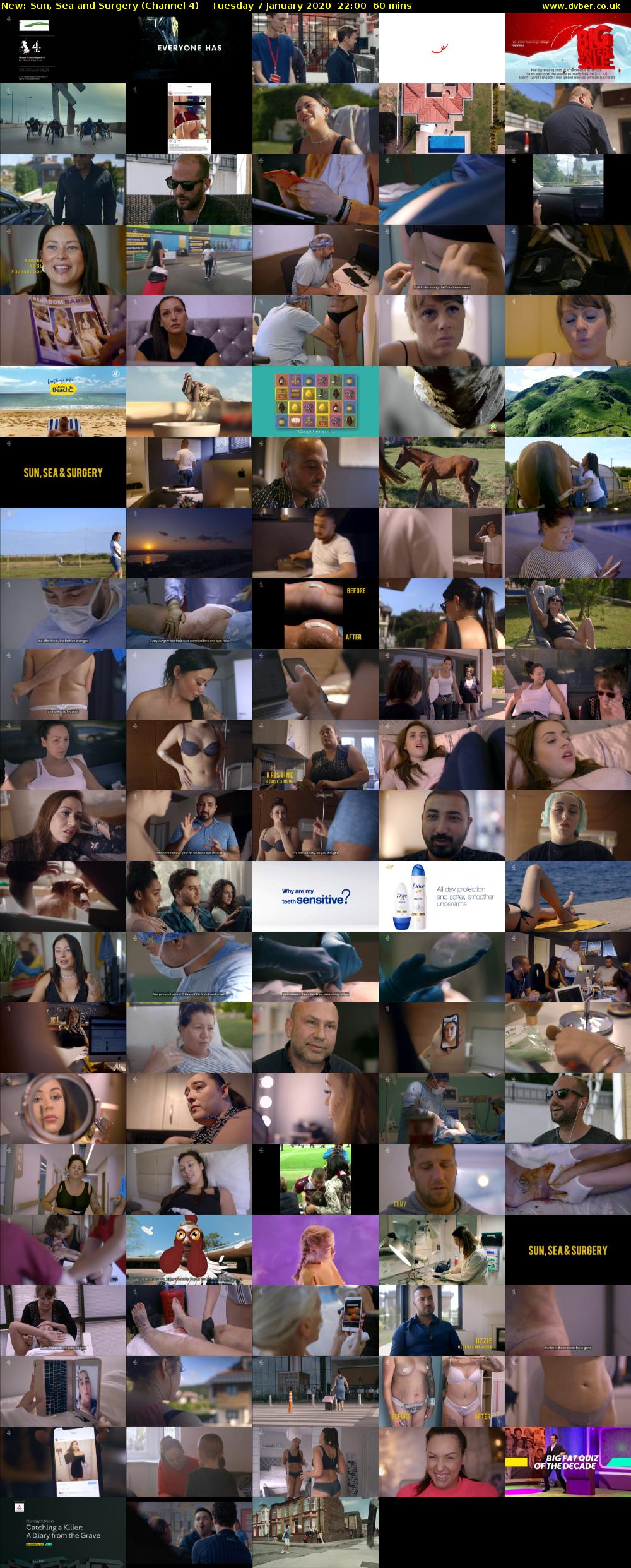 Sun, Sea and Surgery (Channel 4) Tuesday 7 January 2020 22:00 - 23:00