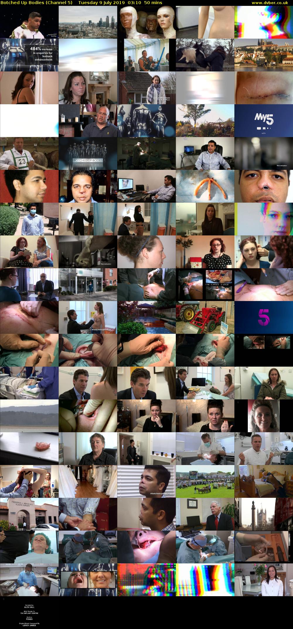 Botched Up Bodies (Channel 5) Tuesday 9 July 2019 03:10 - 04:00