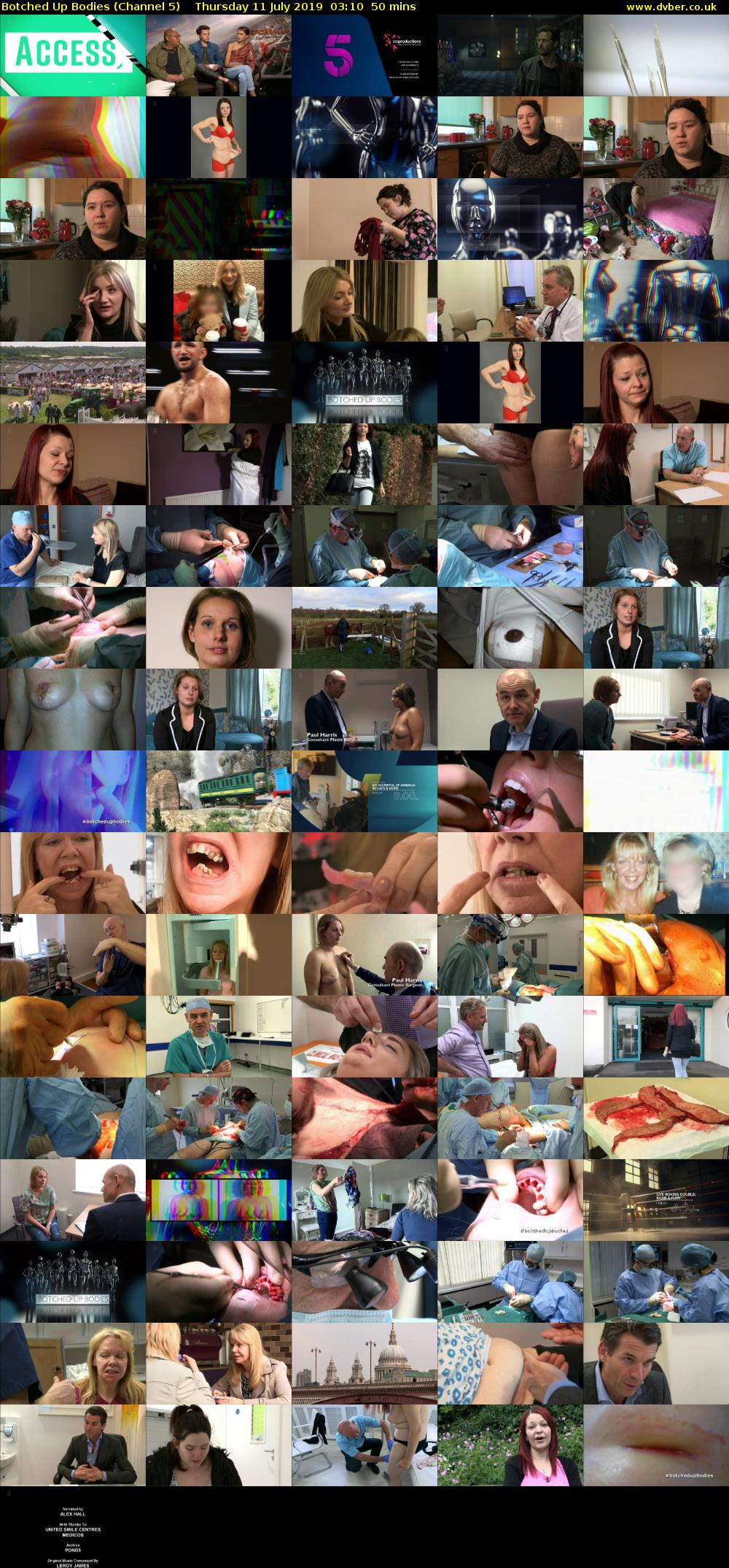 Botched Up Bodies (Channel 5) Thursday 11 July 2019 03:10 - 04:00