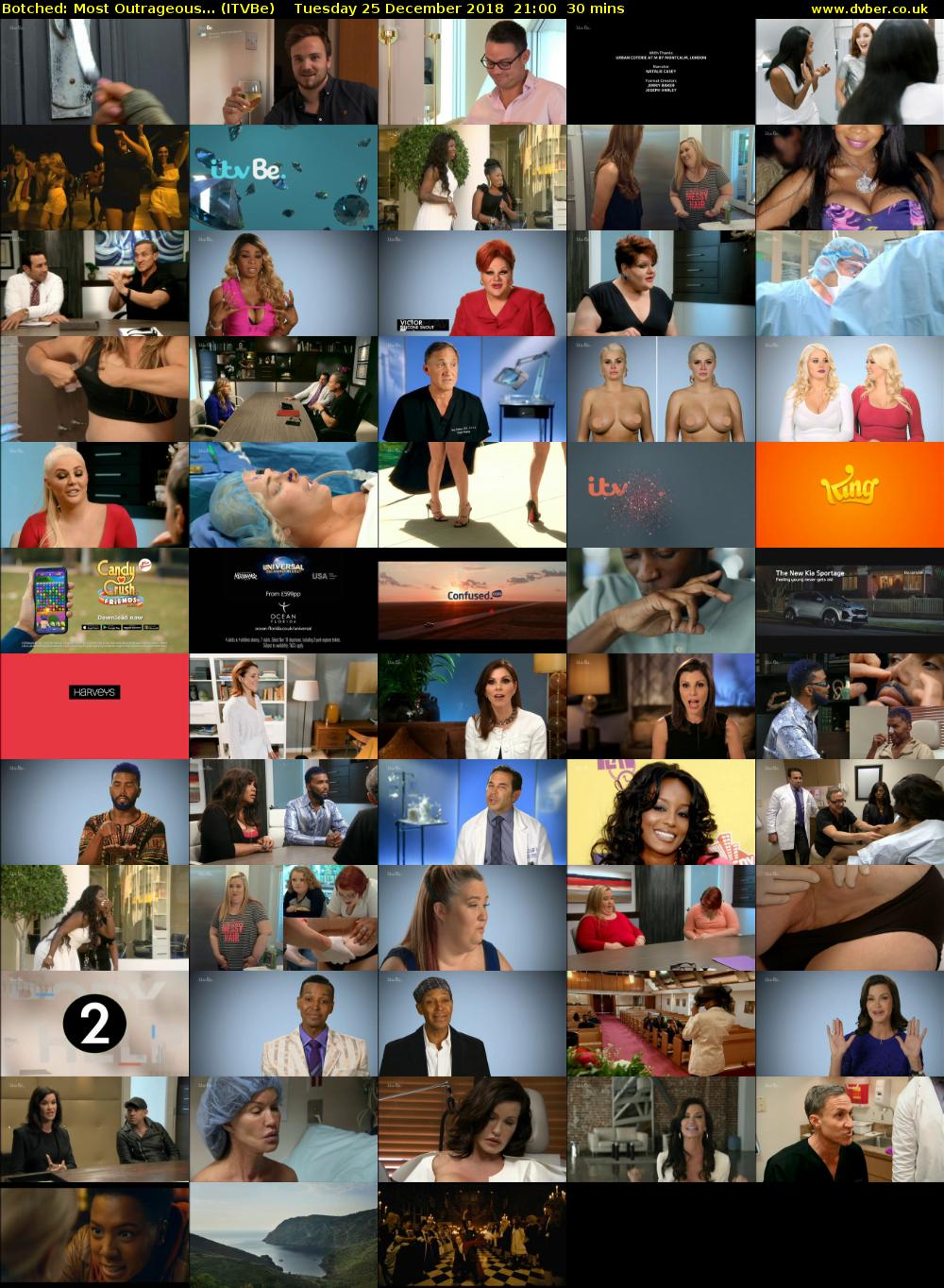 Botched: Most Outrageous... (ITVBe) Tuesday 25 December 2018 21:00 - 21:30