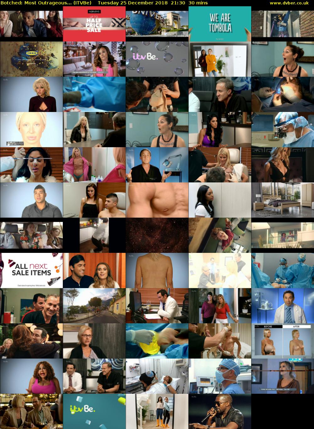 Botched: Most Outrageous... (ITVBe) Tuesday 25 December 2018 21:30 - 22:00