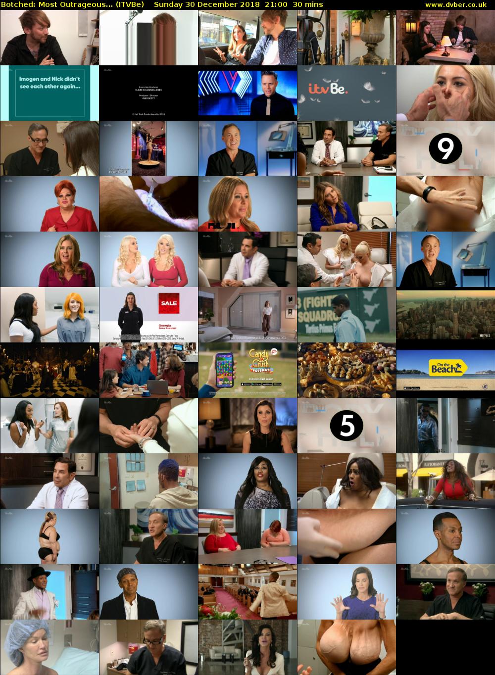 Botched: Most Outrageous... (ITVBe) Sunday 30 December 2018 21:00 - 21:30