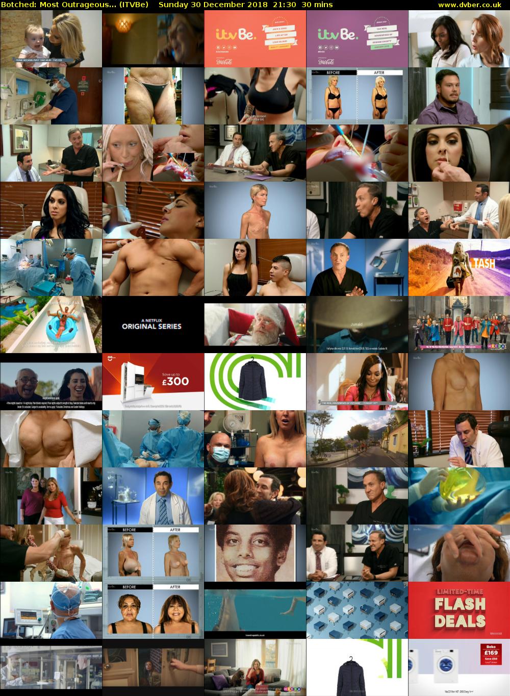 Botched: Most Outrageous... (ITVBe) Sunday 30 December 2018 21:30 - 22:00