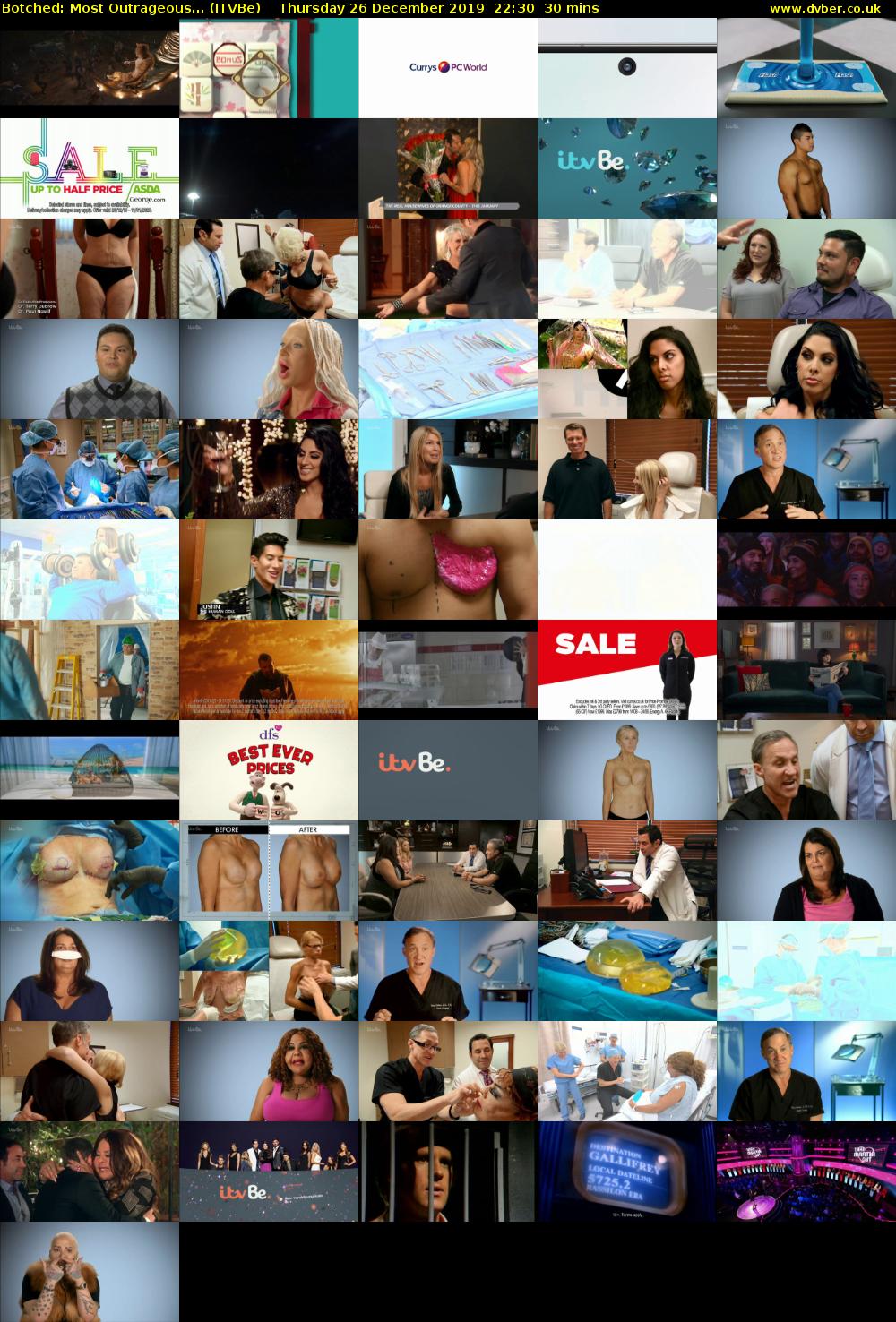 Botched: Most Outrageous... (ITVBe) Thursday 26 December 2019 22:30 - 23:00