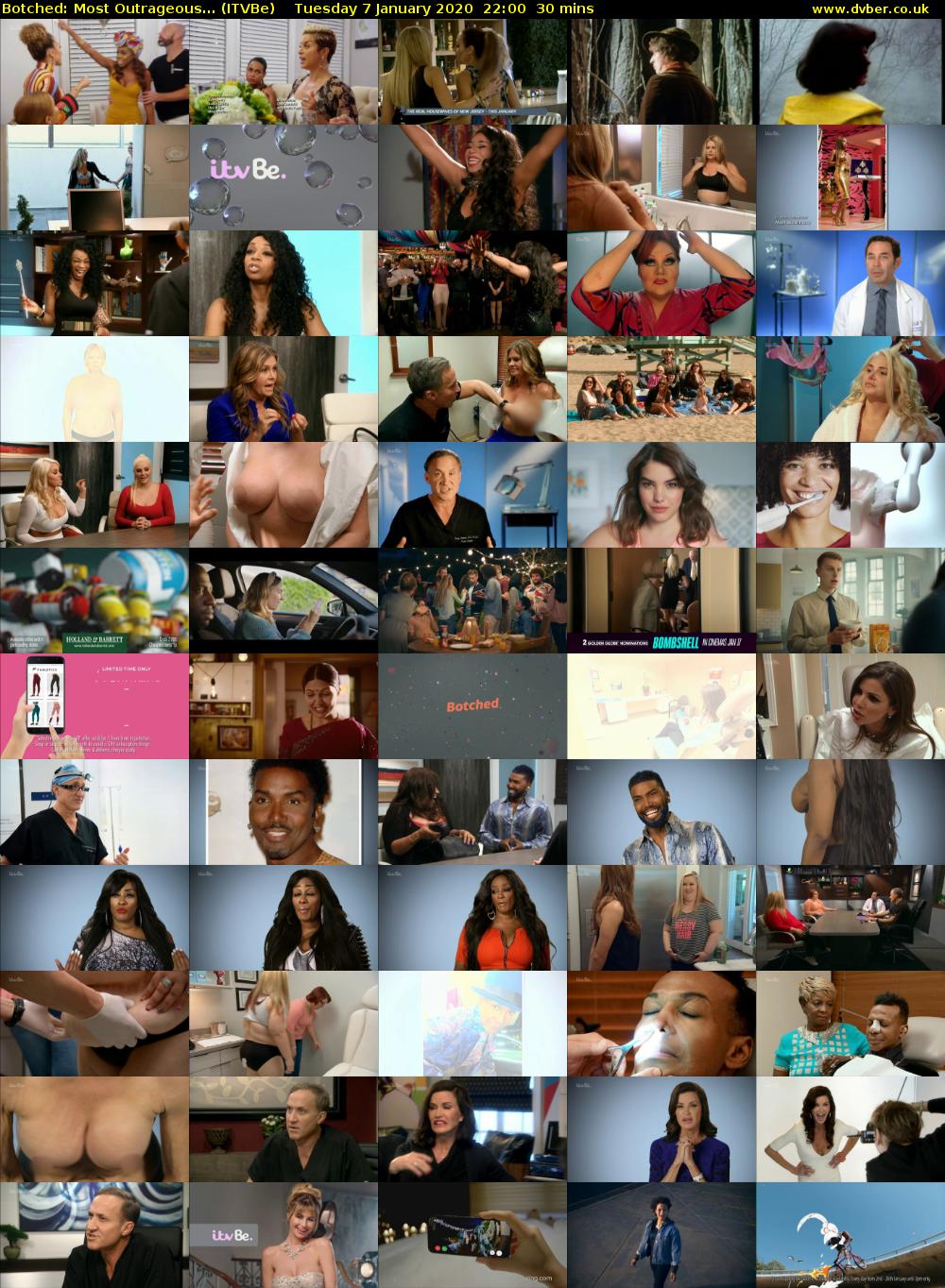 Botched: Most Outrageous... (ITVBe) Tuesday 7 January 2020 22:00 - 22:30