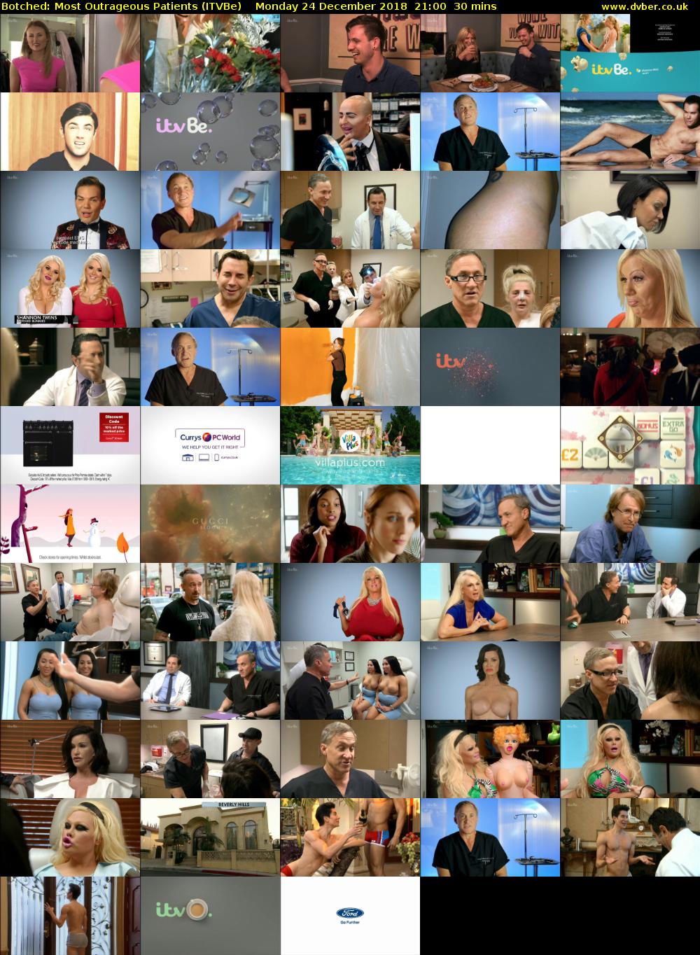 Botched: Most Outrageous Patients (ITVBe) Monday 24 December 2018 21:00 - 21:30