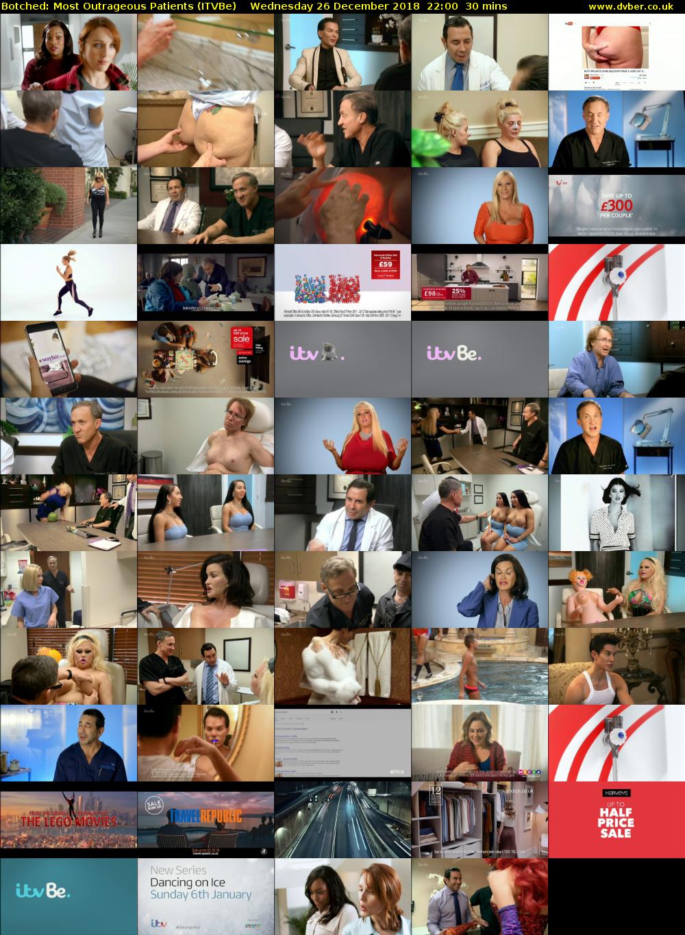 Botched: Most Outrageous Patients (ITVBe) Wednesday 26 December 2018 22:00 - 22:30