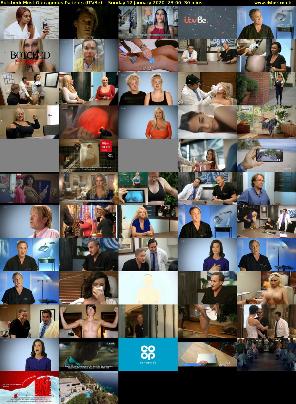 Botched: Most Outrageous Patients (ITVBe) Sunday 12 January 2020 23:00 - 23:30
