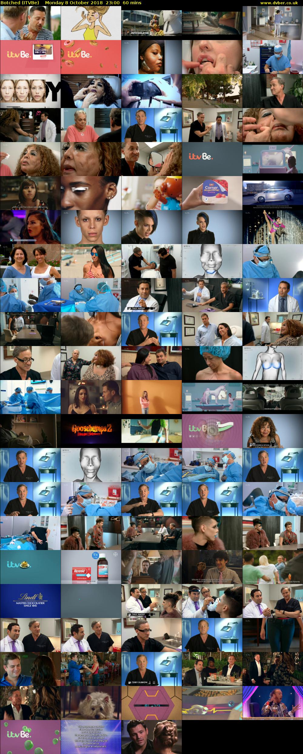 Botched (ITVBe) Monday 8 October 2018 23:00 - 00:00