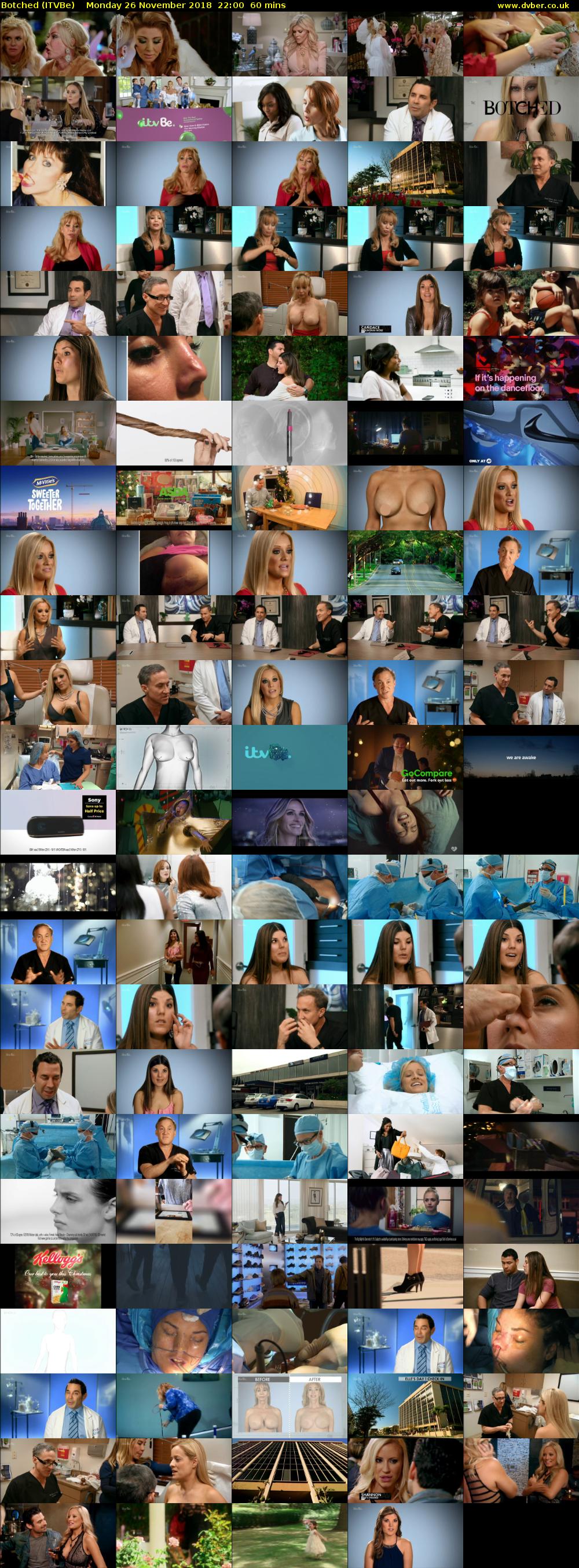 Botched (ITVBe) Monday 26 November 2018 22:00 - 23:00