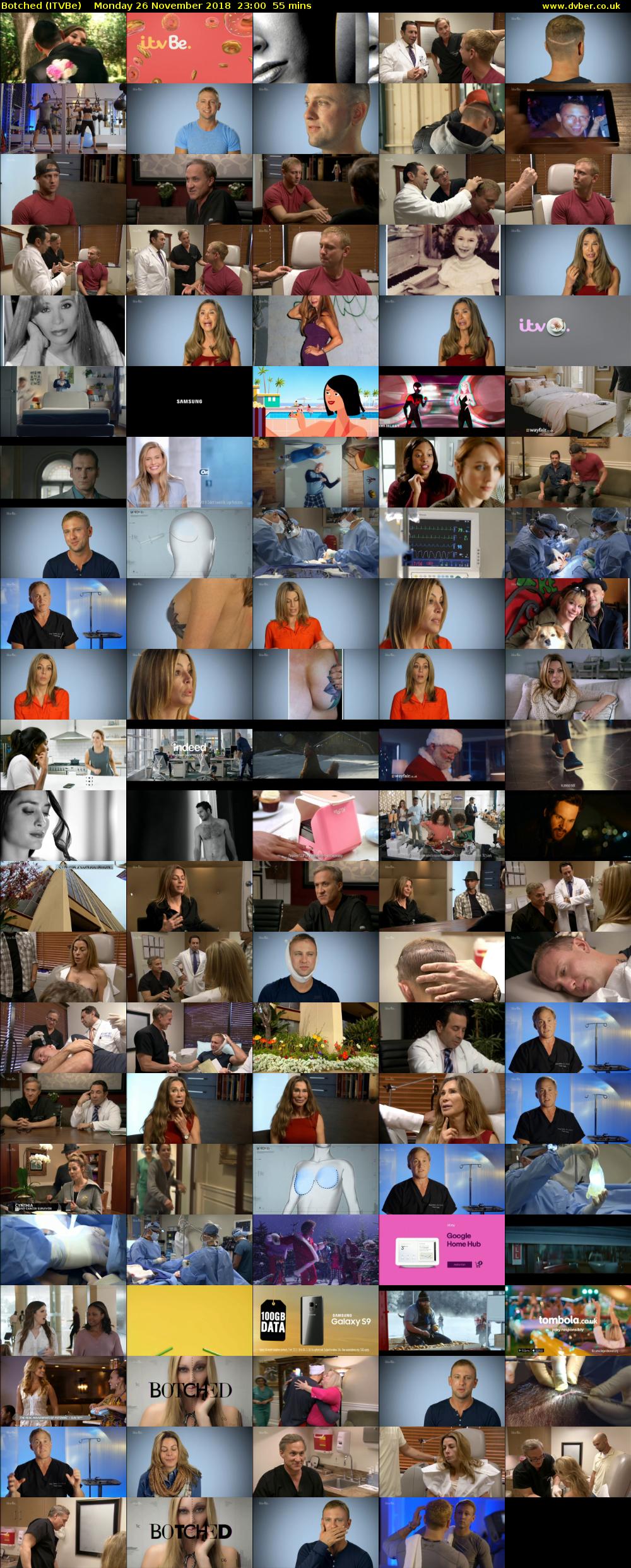 Botched (ITVBe) Monday 26 November 2018 23:00 - 23:55