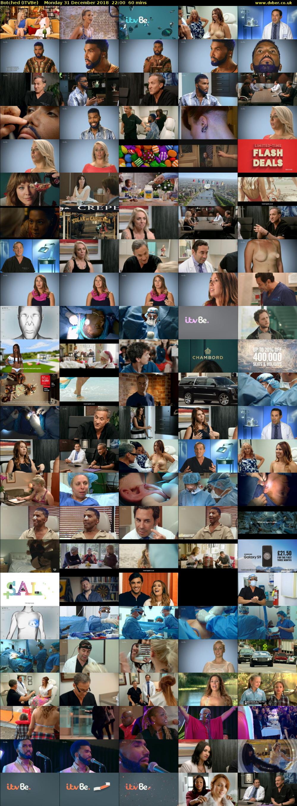 Botched (ITVBe) Monday 31 December 2018 22:00 - 23:00