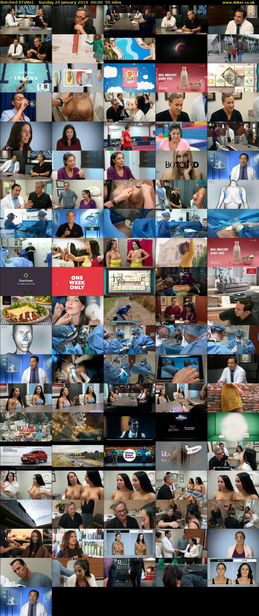 Botched (ITVBe) Sunday 20 January 2019 00:00 - 00:55