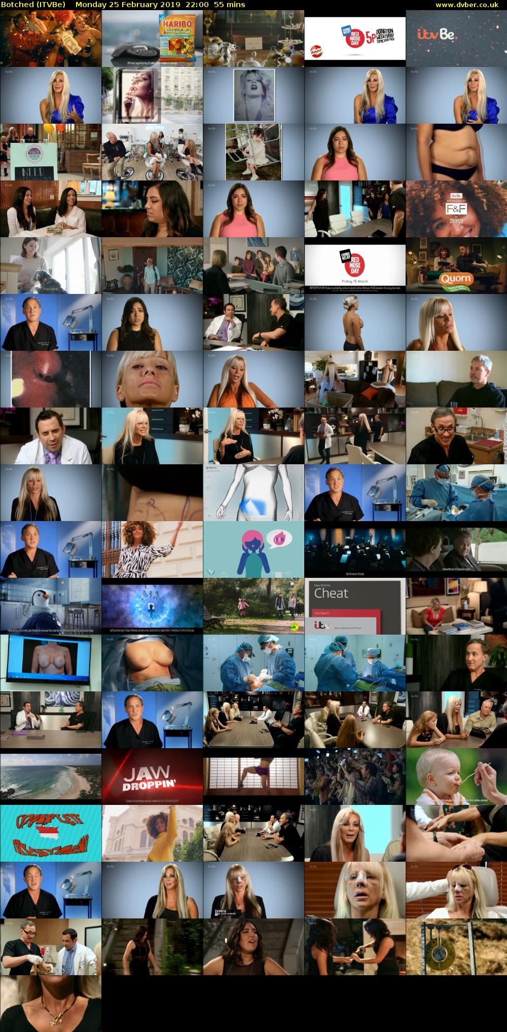 Botched (ITVBe) Monday 25 February 2019 22:00 - 22:55