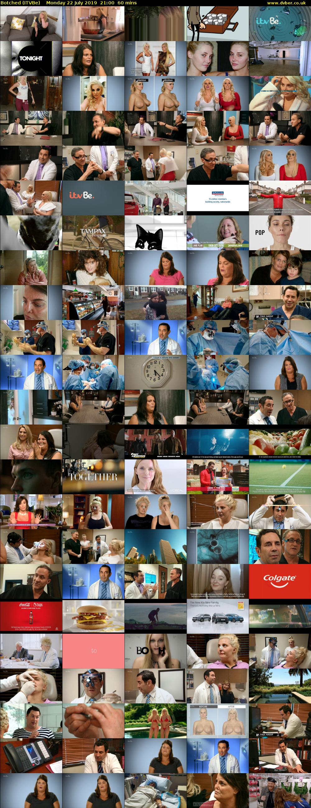 Botched (ITVBe) Monday 22 July 2019 21:00 - 22:00