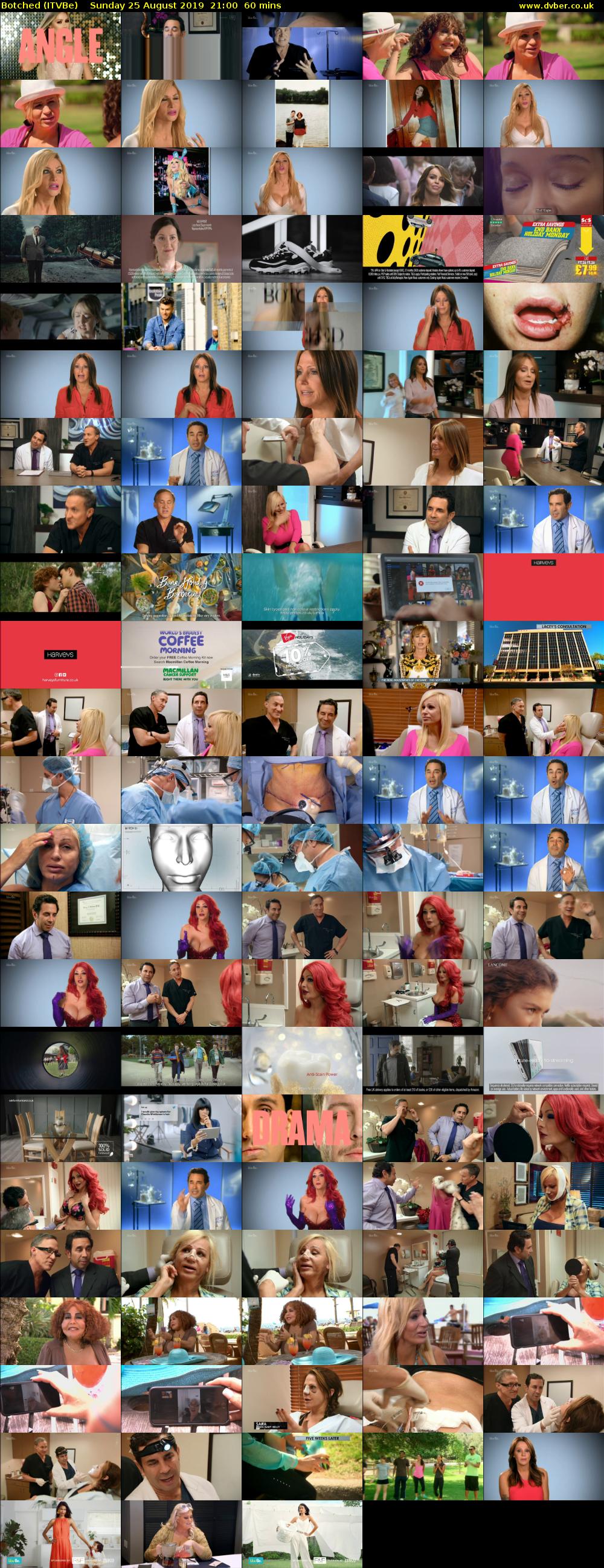 Botched (ITVBe) Sunday 25 August 2019 21:00 - 22:00