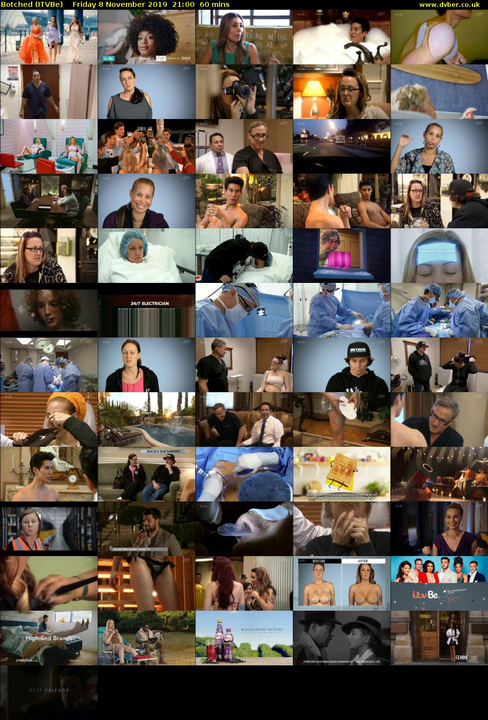 Botched (ITVBe) Friday 8 November 2019 21:00 - 22:00