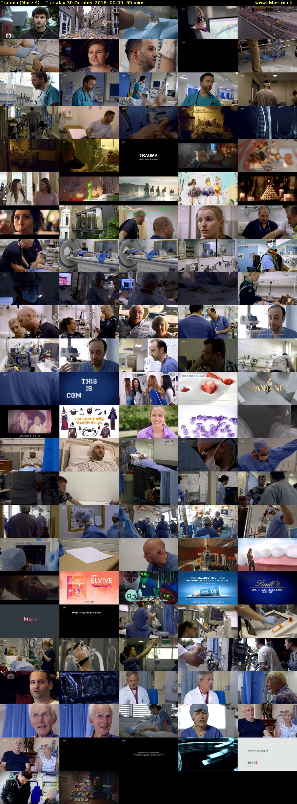 Trauma (More 4) Tuesday 30 October 2018 00:05 - 01:10