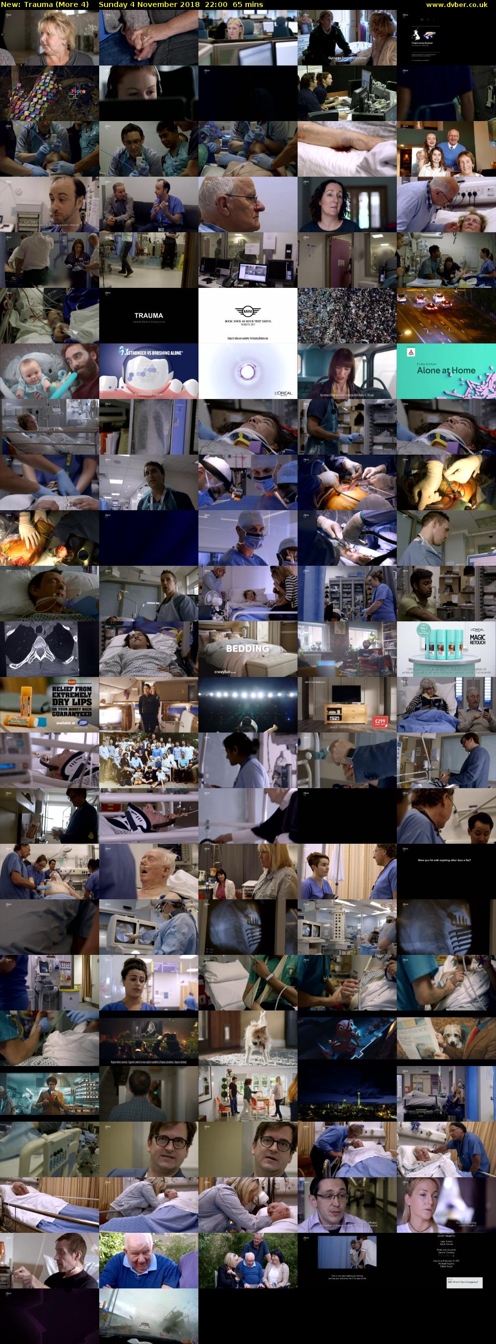 Trauma (More 4) Sunday 4 November 2018 22:00 - 23:05