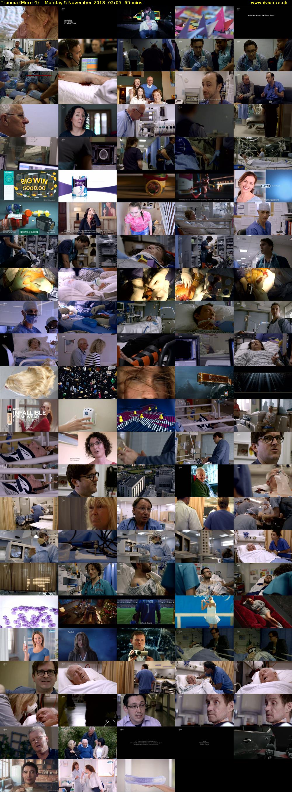 Trauma (More 4) Monday 5 November 2018 02:05 - 03:10