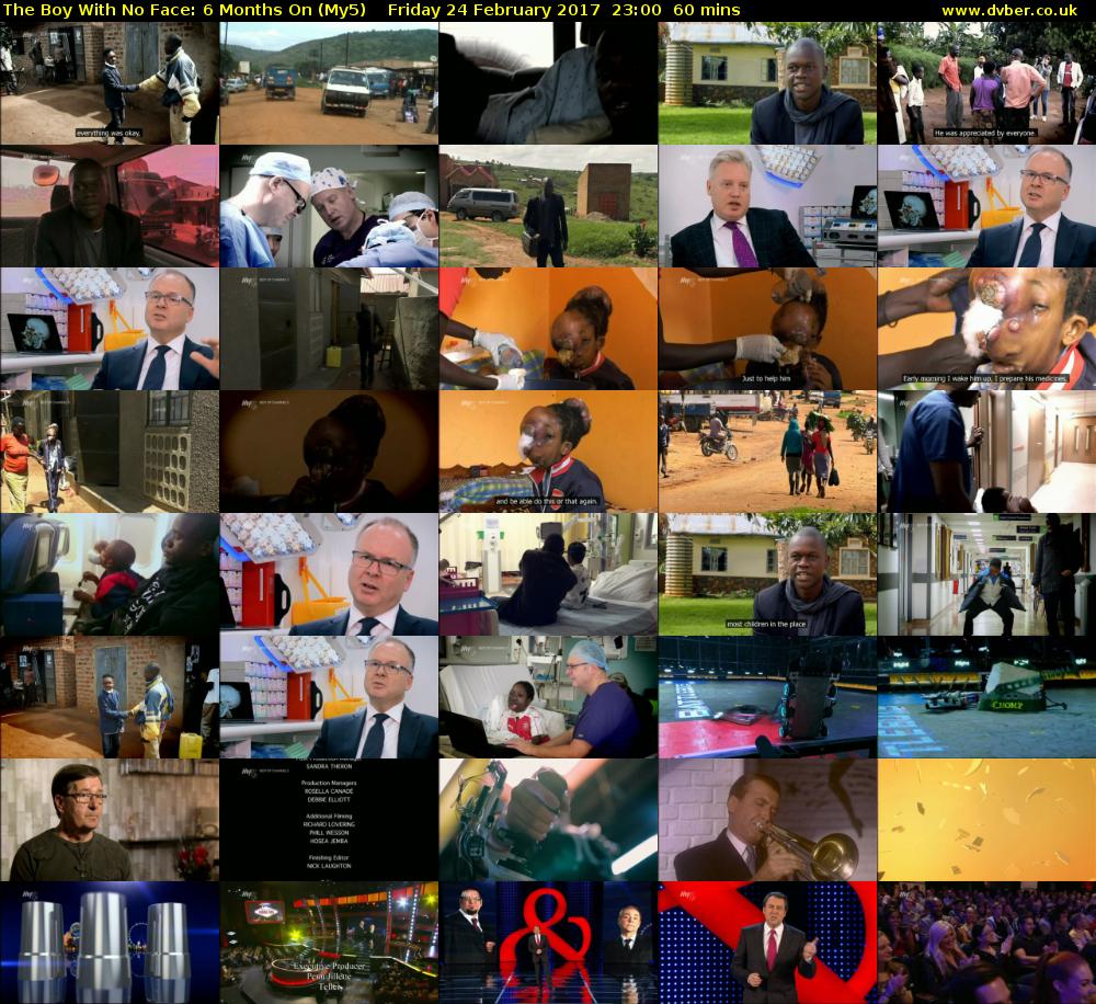 The Boy With No Face: 6 Months On (My5) Friday 24 February 2017 23:00 - 00:00