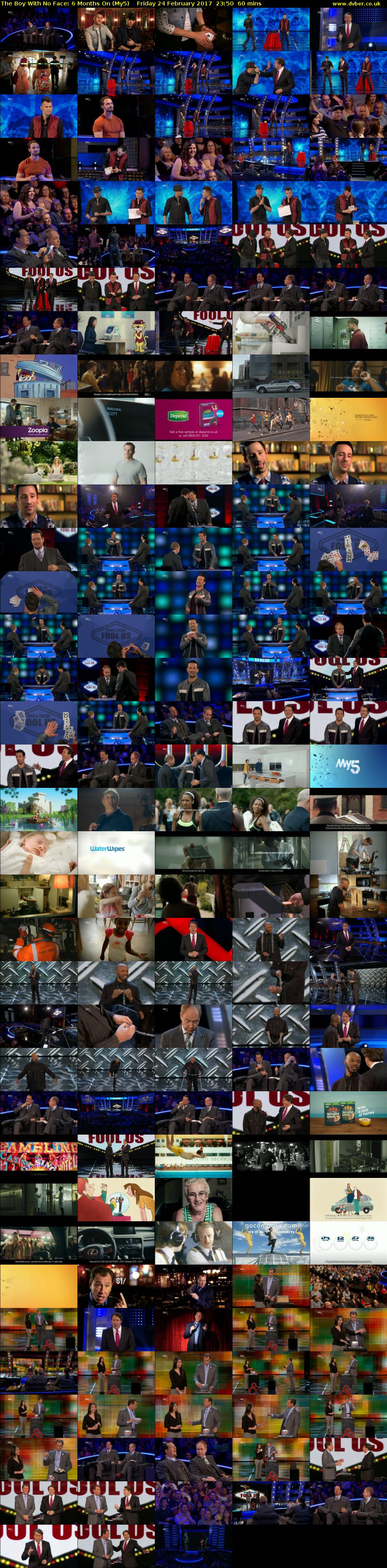 The Boy With No Face: 6 Months On (My5) Friday 24 February 2017 23:50 - 00:50