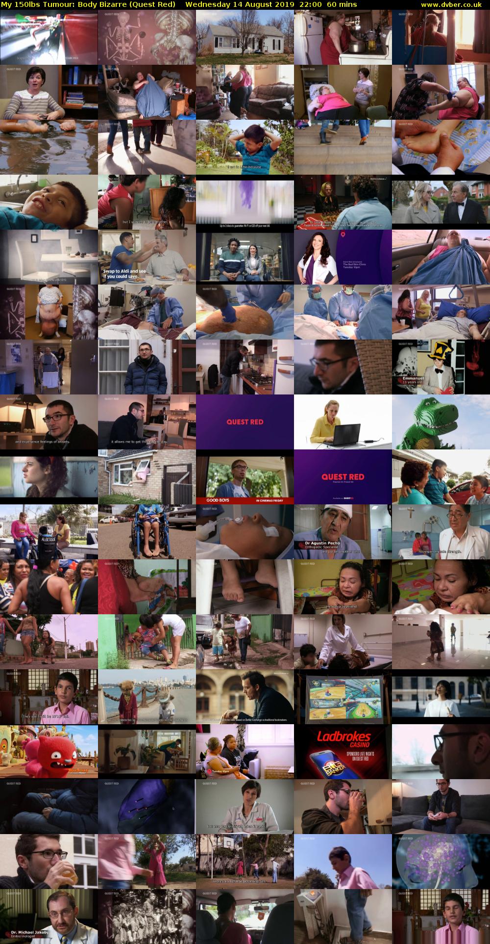 My 150lbs Tumour: Body Bizarre (Quest Red) Wednesday 14 August 2019 22:00 - 23:00