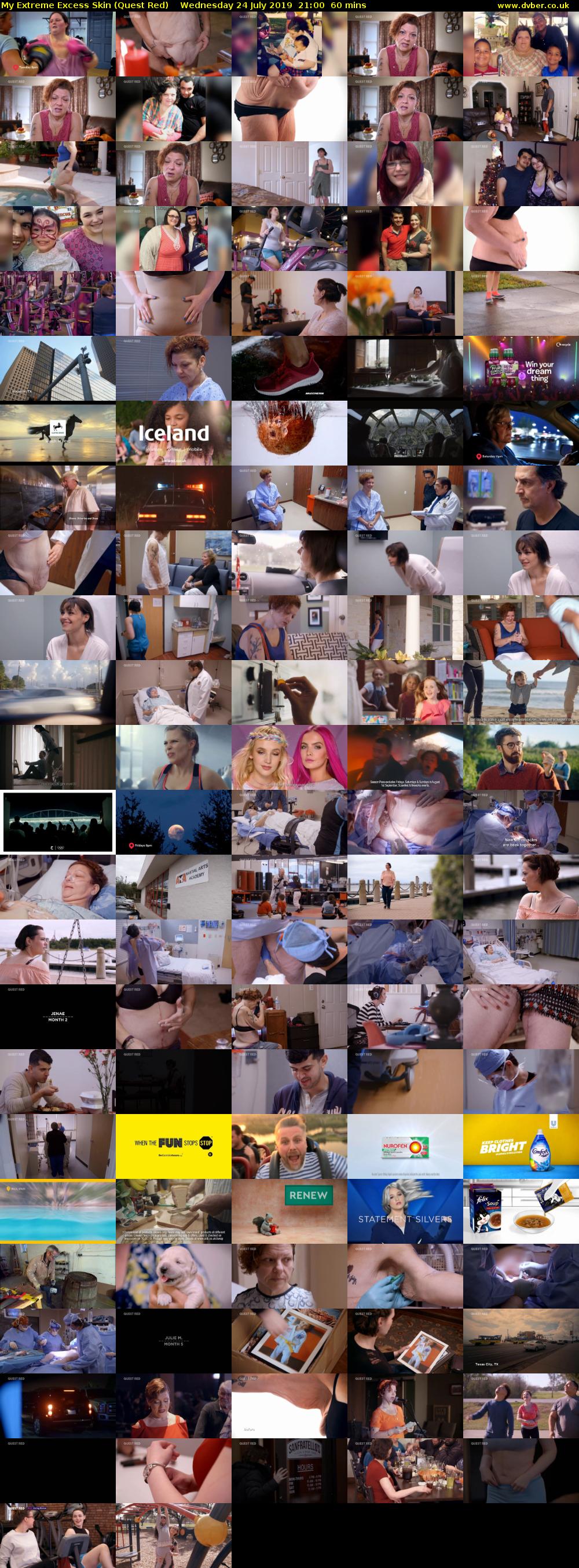 My Extreme Excess Skin (Quest Red) Wednesday 24 July 2019 21:00 - 22:00