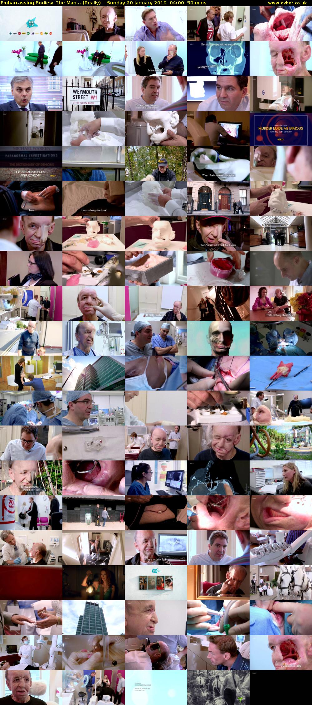 Embarrassing Bodies: The Man... (Really) Sunday 20 January 2019 04:00 - 04:50