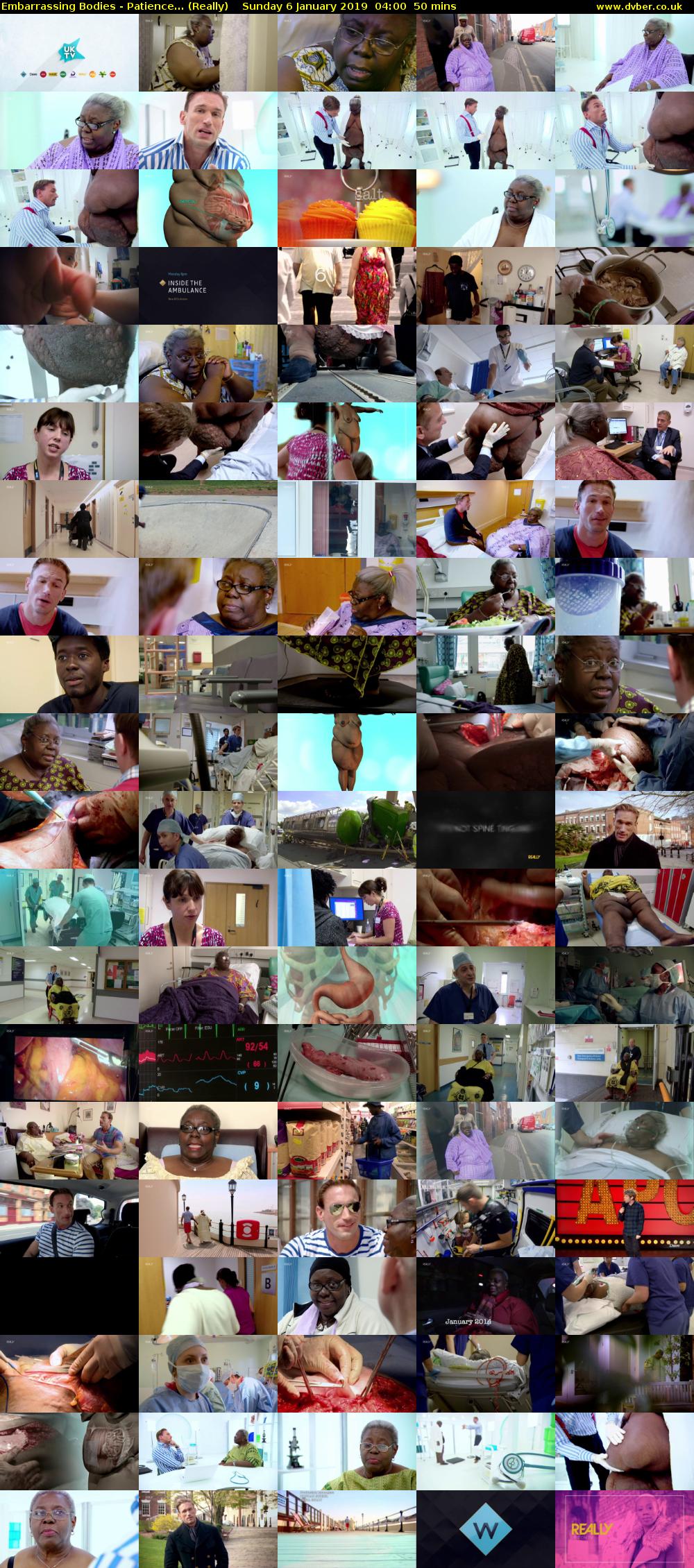 Embarrassing Bodies - Patience... (Really) Sunday 6 January 2019 04:00 - 04:50