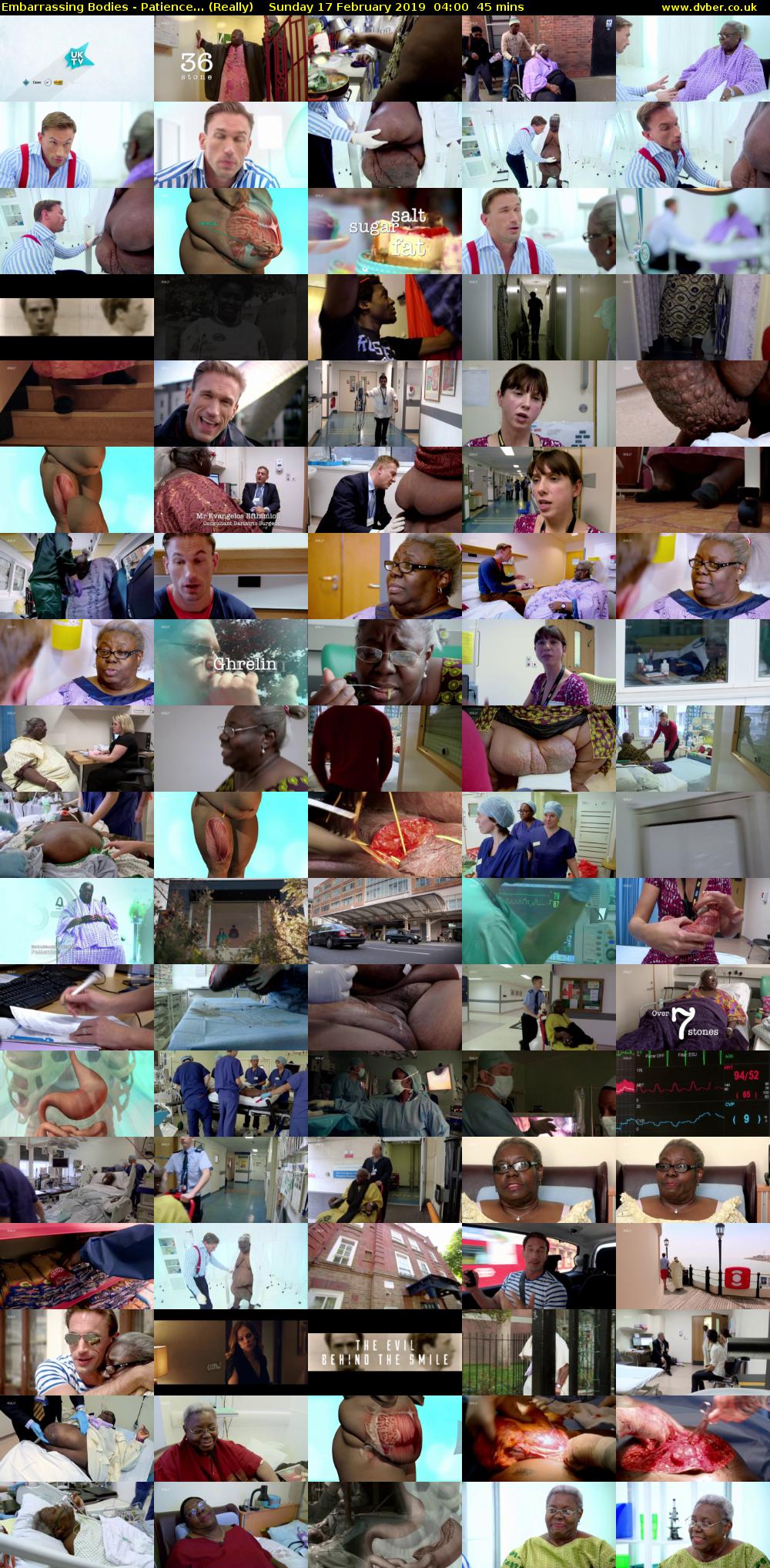 Embarrassing Bodies - Patience... (Really) Sunday 17 February 2019 04:00 - 04:45