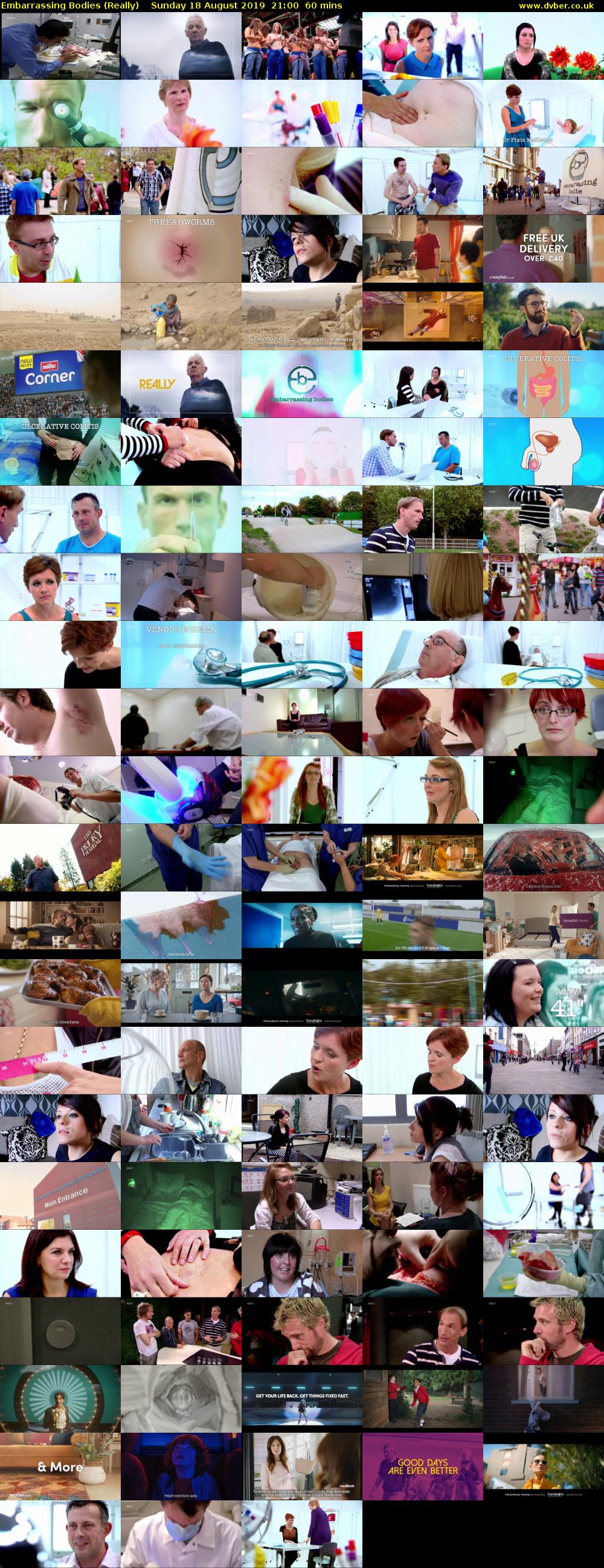 Embarrassing Bodies (Really) Sunday 18 August 2019 21:00 - 22:00