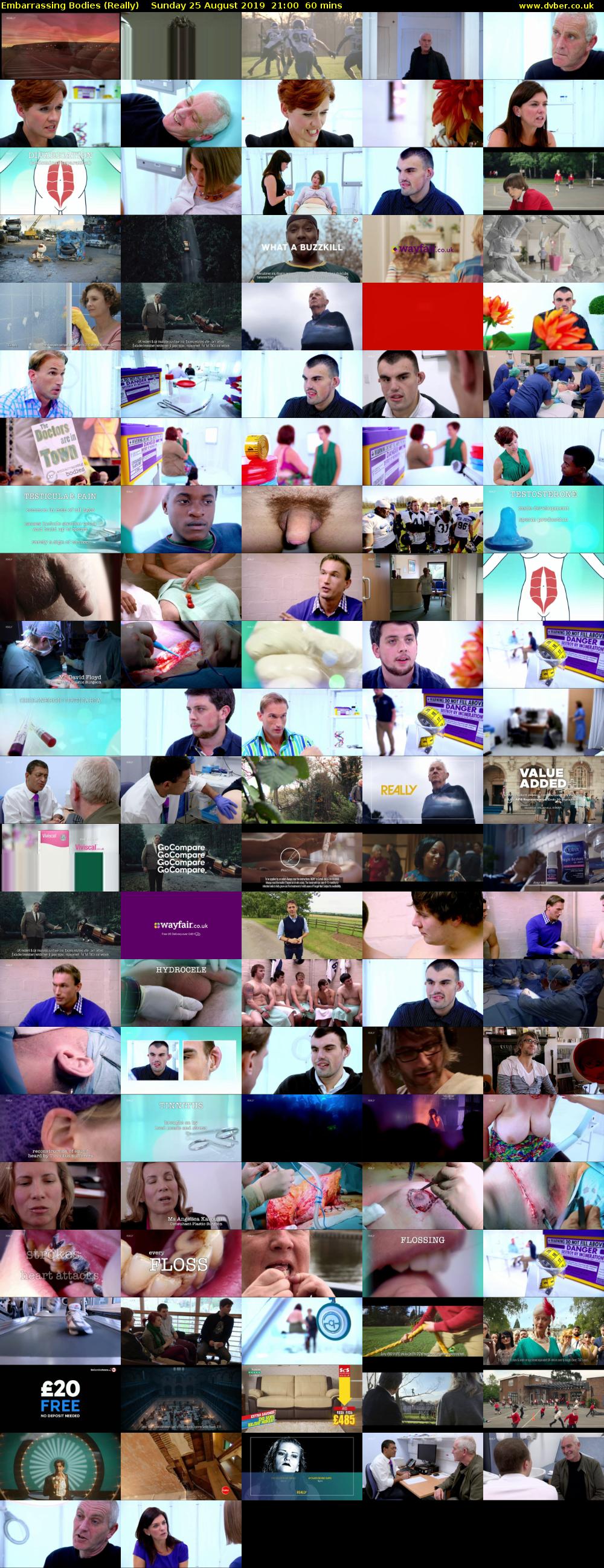 Embarrassing Bodies (Really) Sunday 25 August 2019 21:00 - 22:00