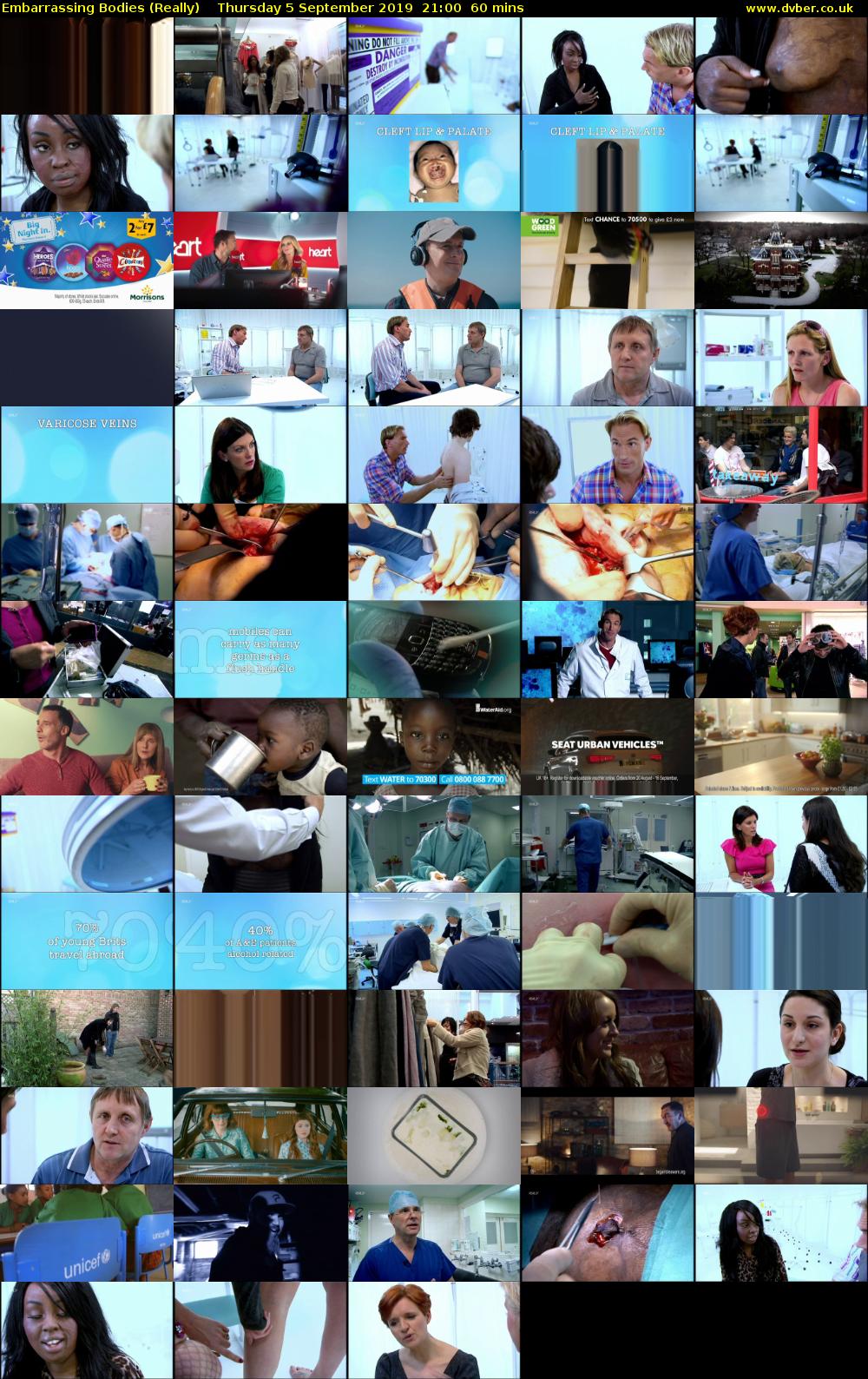 Embarrassing Bodies (Really) Thursday 5 September 2019 21:00 - 22:00