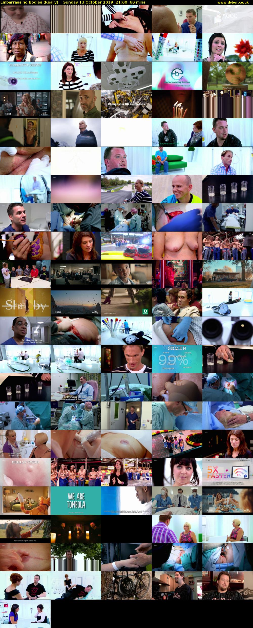 Embarrassing Bodies (Really) Sunday 13 October 2019 21:00 - 22:00