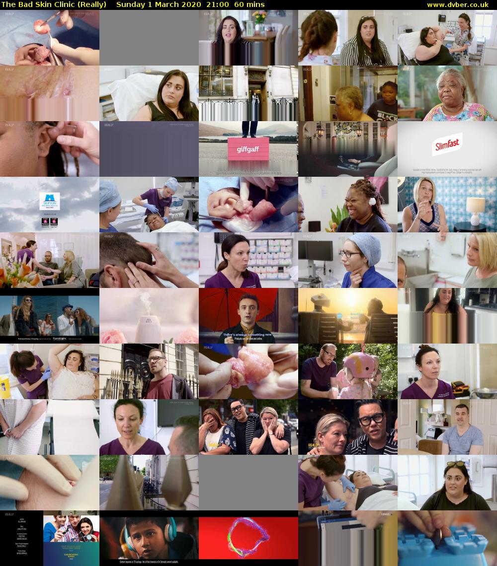The Bad Skin Clinic (Really) Sunday 1 March 2020 21:00 - 22:00